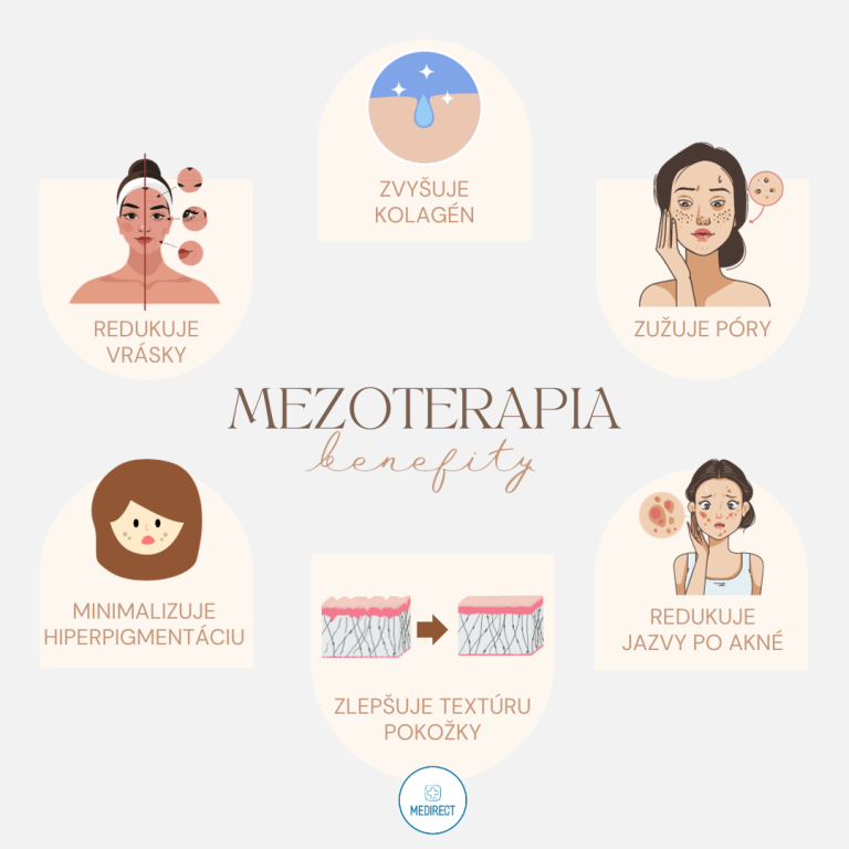 Benefity mezoterapie