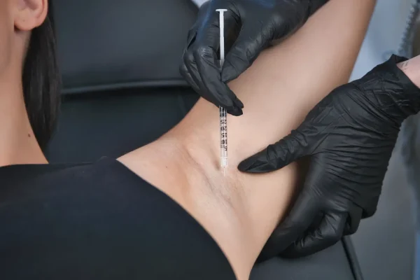 Medirect odstranenie potenia 01 2026